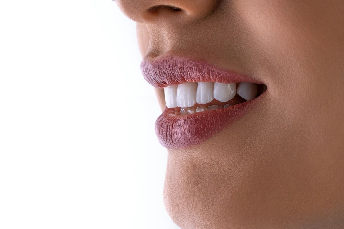 Close-up of a restored, natural-looking smile